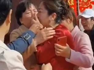 Cô dâu có vết bớt ở tay, mẹ chú rể bàng hoàng phát hiện đó là con gái ruột