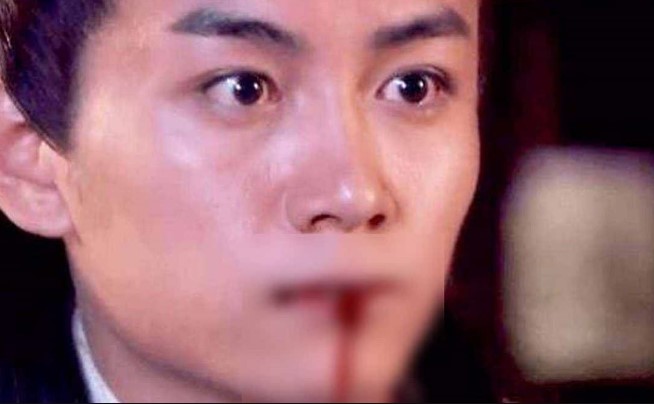 Cắn lưỡi có thực sự chết giống như trong phim? Tại sao cắt lưỡi thì lại không chết mà chỉ bị câm?