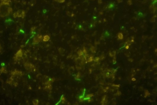 Phát hiện sốc: Đàn sinh vật sống sót sau 2 tỉ năm bị nhốt trong đá