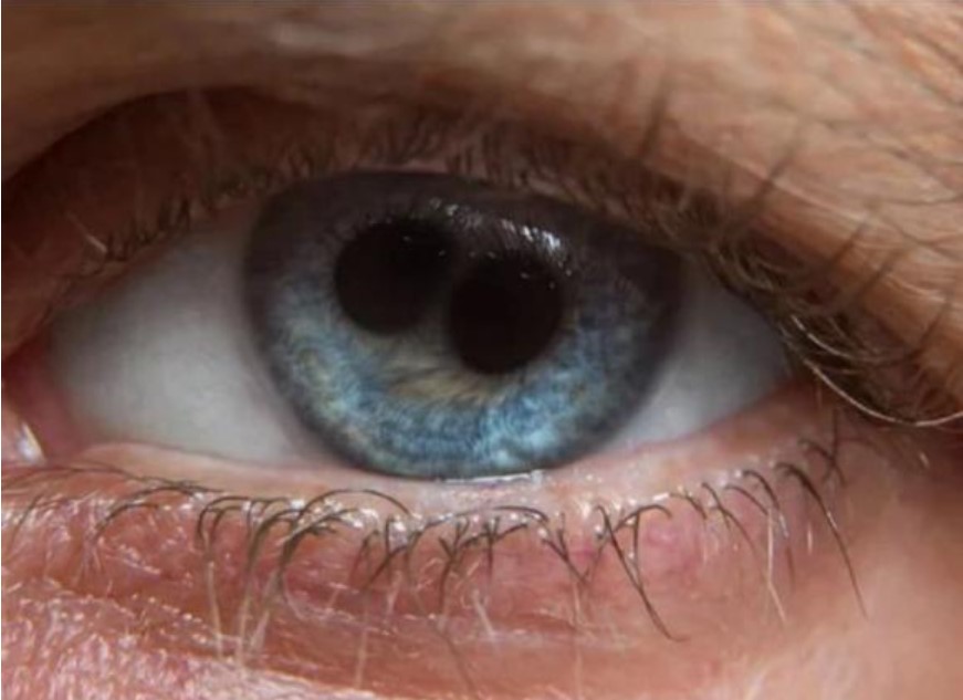 'Đồng tử kép' - Bí ẩn đôi mắt gắn liền với 8 vị thánh nhân và hoàng đế, tróng đó có Tần Thuỷ Hoàng