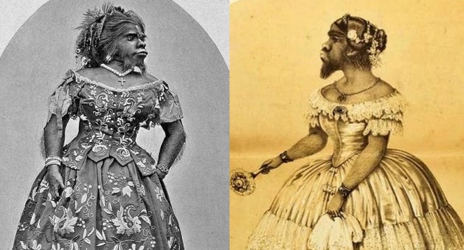 Chân dung người phụ nữ xấu xí nhất thế giới, cuộc đời đầy rẫy bi kịch, đến chết vẫn bị dày vò