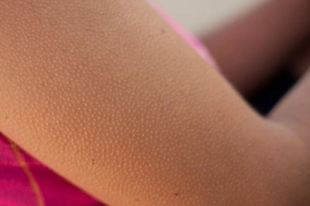 Bỗng dưng nổi da gà là điềm tốt hay xấu?