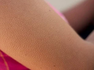 Bỗng dưng nổi da gà là điềm tốt hay xấu?