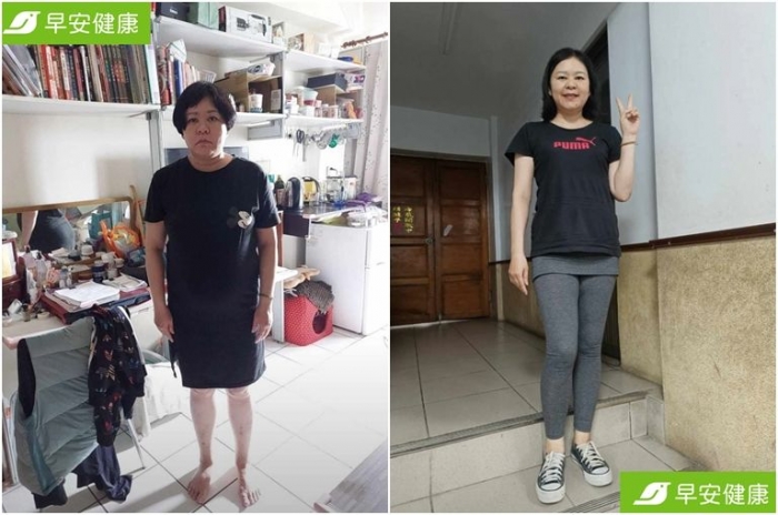 Hết gan nhiễm mỡ và tiết kiệm 1 tỷ tiền phẫu thuật bằng cách làm không ai ngờ tới