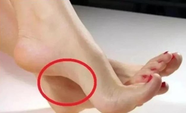 4 tướng bàn chân của người có tiền, sau 30 tuổi phát tài phát lộc, tiền về tới tấp