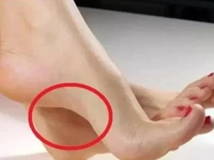 4 tướng bàn chân của người có tiền, sau 30 tuổi phát tài phát lộc, tiền về tới tấp
