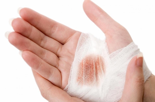 Cách cầm máu vết thương nhanh chóng, hiệu quả