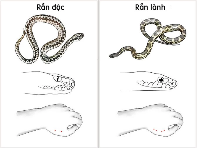 Sơ cứu rắn cắn