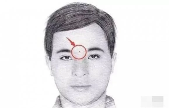 nốt ruồi, bói nốt ruồi, nốt ruồi may mắn