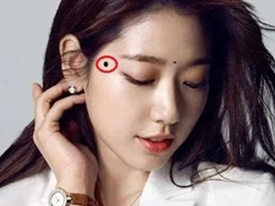 5 nốt ruồi may mắn nhất! Nhìn xem, bạn có bao nhiêu?