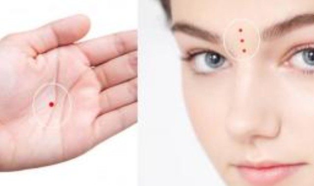 Nốt ruồi son ở vị trí này báo vận đỏ như son, tiền bạc rủng rỉnh, phú quý ngập tràn, bạn có cái nào không?