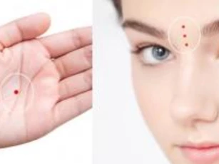 Nốt ruồi son ở vị trí này báo vận đỏ như son, tiền bạc rủng rỉnh, phú quý ngập tràn, bạn có cái nào không?