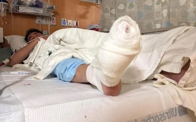 Cận cảnh hiện trường nơi Đàm Vĩnh Hưng gặp tai nạn đứt lìa vài ngón chân, là nơi tụ tập nhiều người nổi tiếng