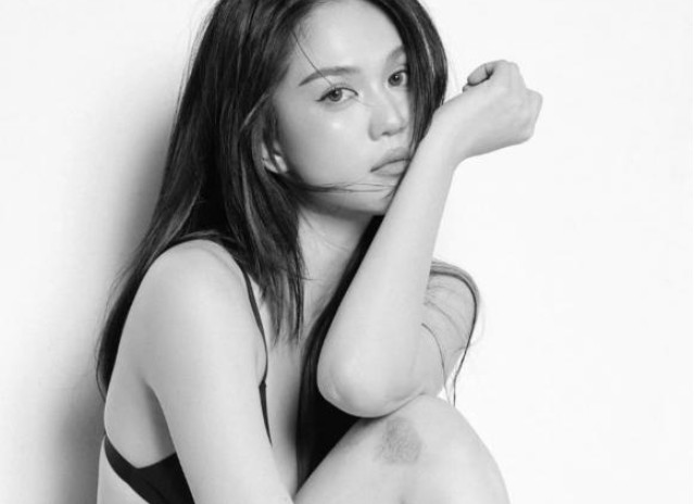 Ngọc Trinh diện bikini, không ngại để lộ dấu vết 'phạm tội'