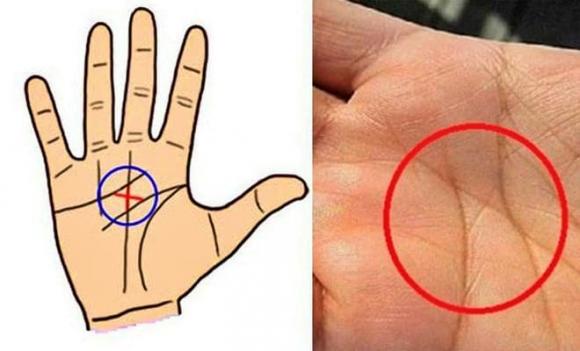 Lòng bàn tay có 1 điểm vàng, tha hồ hưởng phúc, tài lộc tiêu mãi không hết