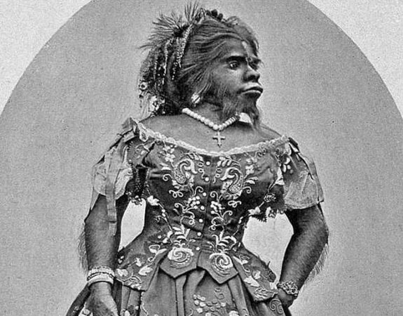 Khám phá bất ngờ về người phụ nữ bị mệnh danh là xấu nhất thế giới