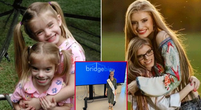 Cặp sinh đôi đặc biệt nhất thế giới: Chị cao 1m74, em chỉ 1m34, nhan sắc ‘một trời một vực’