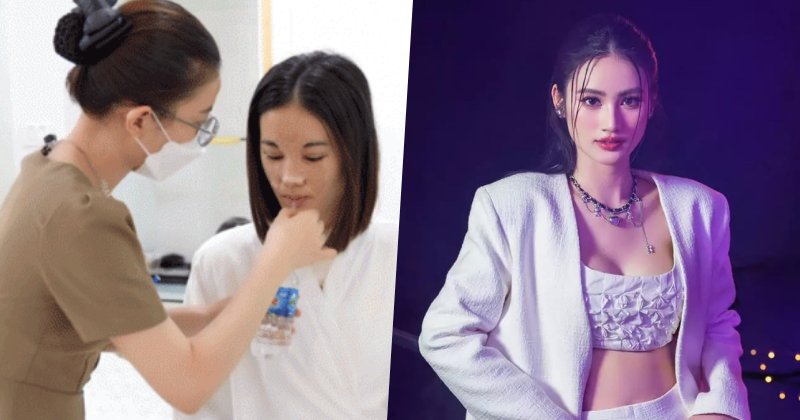 Hoa hậu Ý Nhi lộ ảnh “đập đi xây lại” gương mặt và vòng 1, dân mạng phản ứng ra sao?