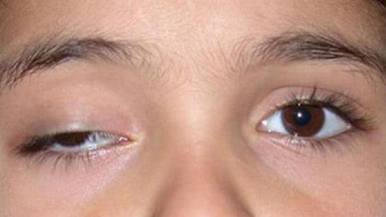 Giật mắt trái đối với nữ là hên hay xui?