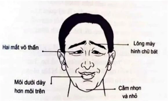 Tướng đàn ông nghèo khổ, nhân tướng học