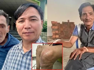 Thương Tín gặp nguy hiểm, chân biến dạng không thể đi lại, khán giả hoảng hốt khi nhìn cận cảnh