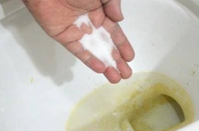 Rắc một ít vào bồn cầu, các vết ố vàng có thể được giải quyết dễ dàng! Nhiều người không biết, siêu dễ làm