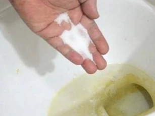 Rắc một ít vào bồn cầu, các vết ố vàng có thể được giải quyết dễ dàng! Nhiều người không biết, siêu dễ làm