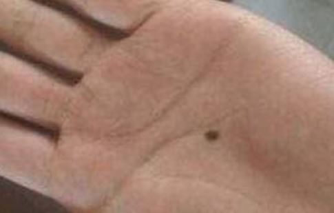 Nếu bạn có nốt ruồi này trên tay, phúc lộc và trường thọ sẽ theo bạn