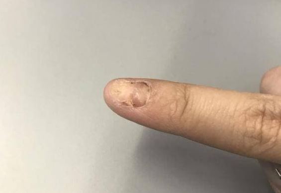 Tại sao các phi hành gia 'rút móng tay' trước khi lên bầu trời? Các chuyên gia hàng không vũ trụ nói sự thật!