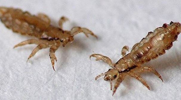 Bất ngờ nguồn gốc của chấy rận hút máu da đầu, nỗi ám ảnh của con người hiện đại