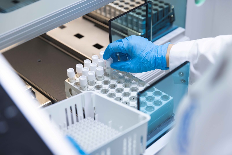 R&#xFA;t ng&#x1EAF;n th&#x1EDD;i gian tr&#x1EA3; k&#x1EBF;t qu&#x1EA3; x&#xE9;t nghi&#x1EC7;m