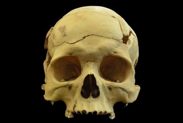 Hộp sọ 2.700 năm tuổi hé lộ điều gây sốc về y học thời cổ đại, thế giới chấn động không dám tin