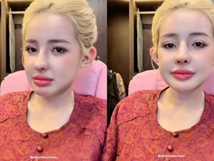 Ngân 98 tiết lộ thời gian sinh con và lí do phải 'dao kéo' liên tục