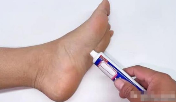 Kem đánh răng bôi vào lòng bàn chân có tác dụng rất tốt, giải quyết được nhiều vấn đề trong gia đình