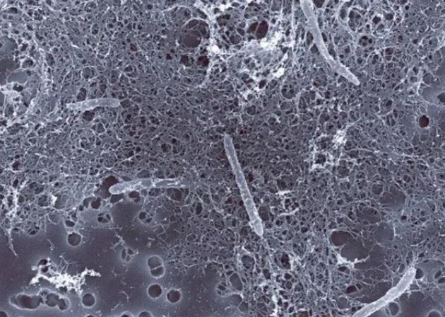 Loài vi sinh vật bí ẩn sống ở 2.800m dưới lòng đất: Sống ở nơi khắc nghiệt hiếm loài nào tồn tại