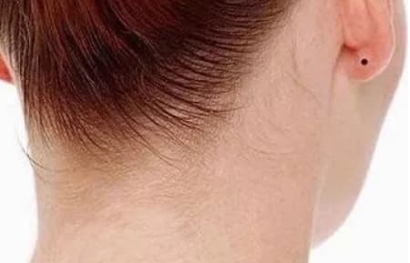 4 nốt ruồi tốt lành hoặc giàu có hoặc quyền quý đều được thừa kế tài sản của tổ tiên và kết hôn với một người đàn ông giàu có