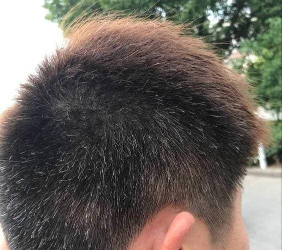 Tóc bạc mọc ở đâu, bệnh tật sẽ đến từ đó? Nếu mọc ở trán, thái dương, sau đầu thì có nghĩa là gì?