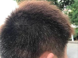 Tóc bạc mọc ở đâu, bệnh tật sẽ đến từ đó? Nếu mọc ở trán, thái dương, sau đầu thì có nghĩa là gì?