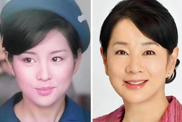 Tại sao mũi lại to hơn khi con người già đi?