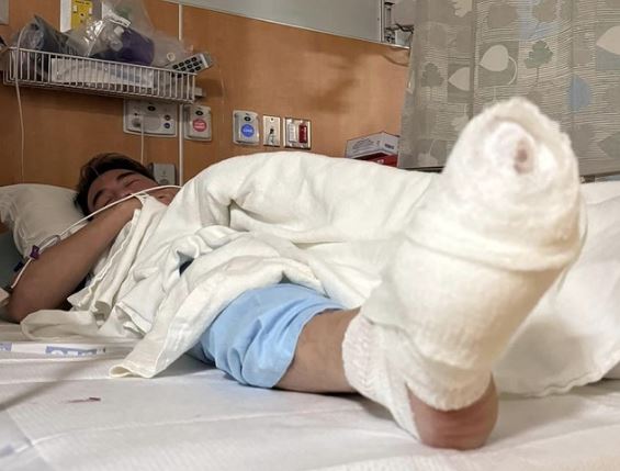 Đàm Vĩnh Hưng một lần nói hết về vết thương ở chân: Vẫn phải dùng giảm đau, vết thương lan sang gối