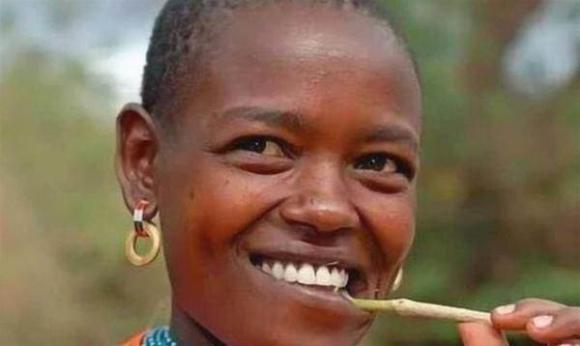 Người Châu Phi ít dùng kem đánh răng, tại sao răng họ vẫn trắng? Nó không chỉ liên quan đến 'màu da đen'