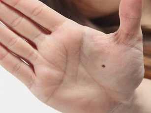 Những nốt ruồi Thần Tài, phú quý giàu sang, tài lộc vượng phát, bất kể nam hay nữ đều hưởng trọn lộc trời