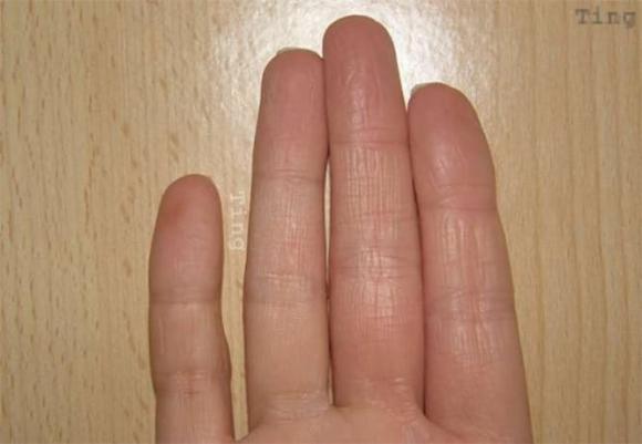 Nhiều người không biết rằng 'độ dài ngón tay út' quyết định cuộc đời của bạn, không ngờ nó còn chính xác hơn cả nhìn mặt!