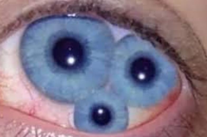 Mèo có đồng tử dọc, dê lại có đồng tử ngang – liệu đây có phải chỉ là sự khác biệt ngẫu nhiên hay ẩn chứa một bí mật tiến hóa đầy thú vị?