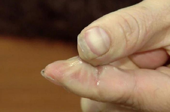 Keo 502 dính vào ngón tay khó gỡ, dạy bạn mẹo đơn giản khiến lớp keo cứng đầu bong ngay