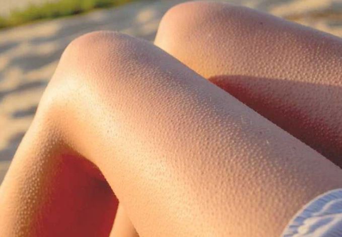 Vì sao con người lại nổi da gà? Phản xạ cổ xưa của tổ tiên vẫn còn hiện diện