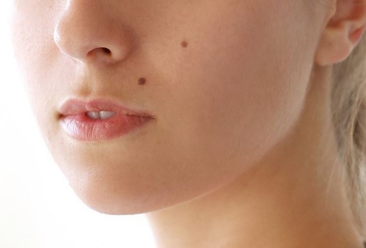 Vì sao con người lại có nốt ruồi? Bí ẩn nhỏ bé trên làn da tiết lộ điều gì về cơ thể bạn