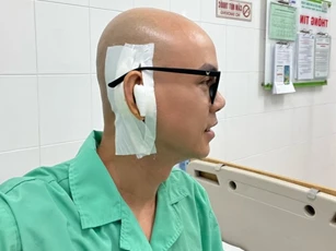 Phan Đinh Tùng ra sao sau ca phẫu thuật vá màng nhĩ?