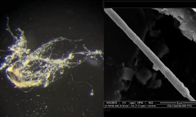 Phát hiện vi khuẩn dẫn điện như dây sống, mở ra tương lai cho công nghệ sinh học