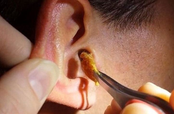 Tại sao chúng ta có ráy tai?